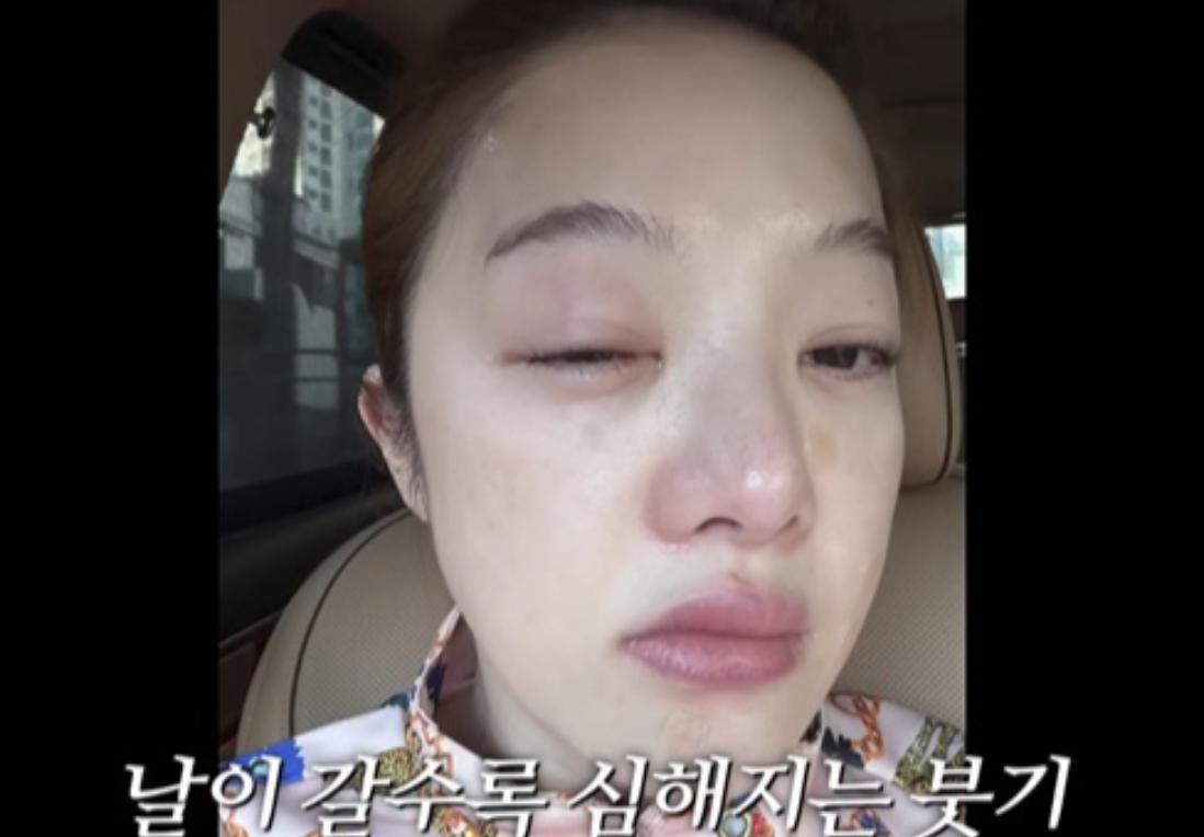  辅助生殖技术下的身体代价：黄宝拉二胎备孕的医学逻辑与风险博弈 健康养生