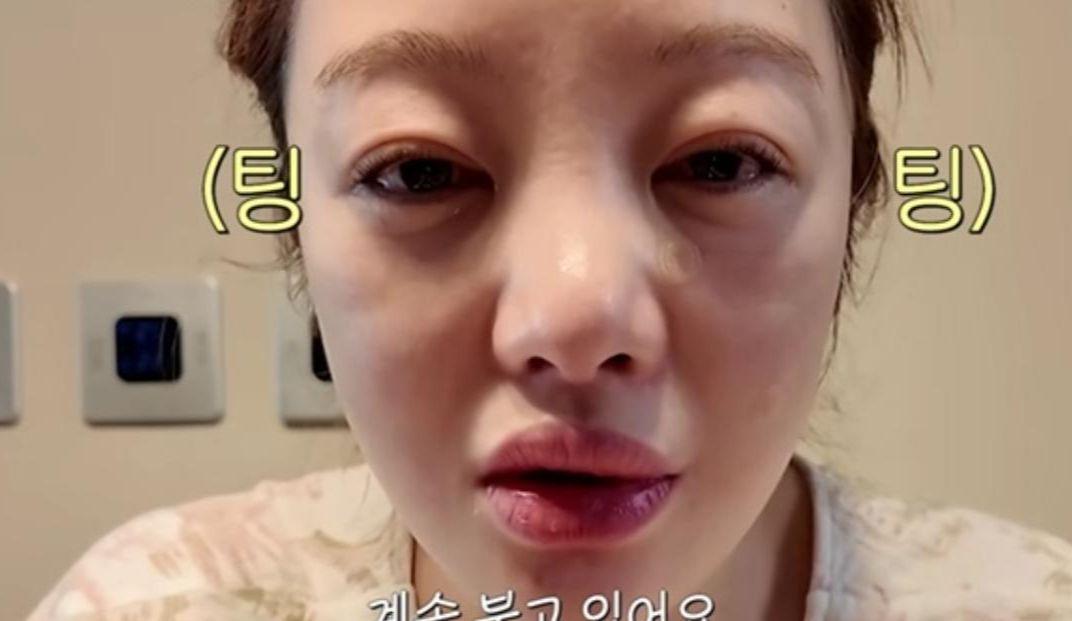  辅助生殖技术下的身体代价：黄宝拉二胎备孕的医学逻辑与风险博弈 健康养生