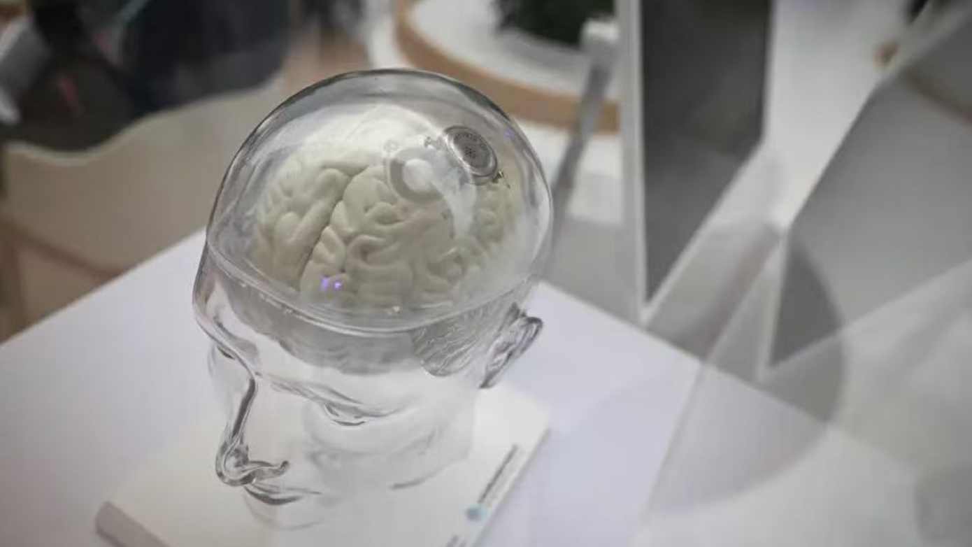  脑机接口离我们到底有多远？湖北省技术创新中心的深度布局与未来启示 IT技术