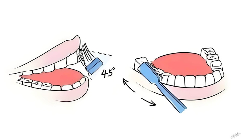 刷牙习惯暗藏隐患,医生提醒:这些常见做法正在削弱护牙效果。 健康养生